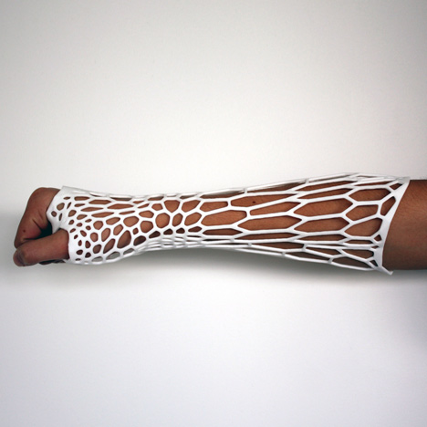 Cortex 3D printed cast for broken bones by Jake Evill