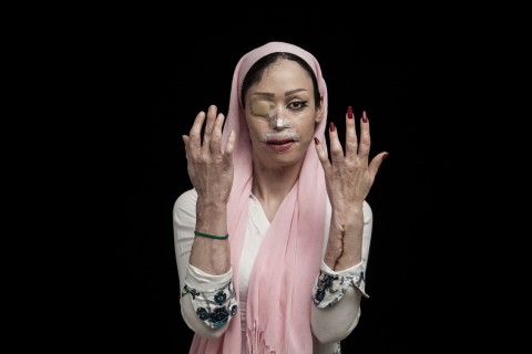 Asghar Khamseh, Il fuoco dell'odio (© Asghar Khamseh, Iran, Photographer of the Year, 2016 Sony World Photography Awards) 