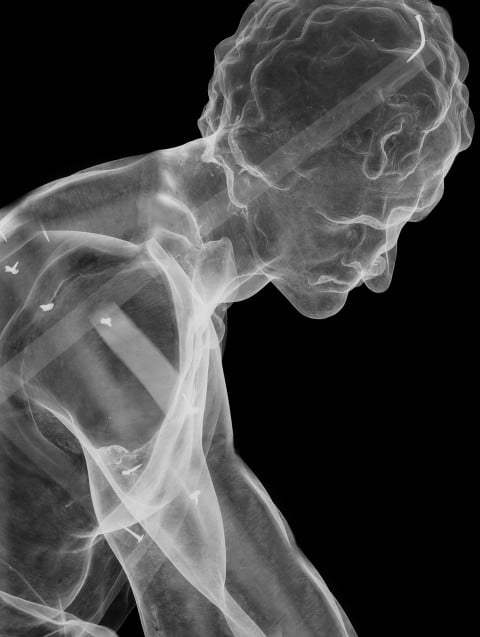 Thierry Radelet, mostrami l'anima 30 x 40 cm radiografia digitale