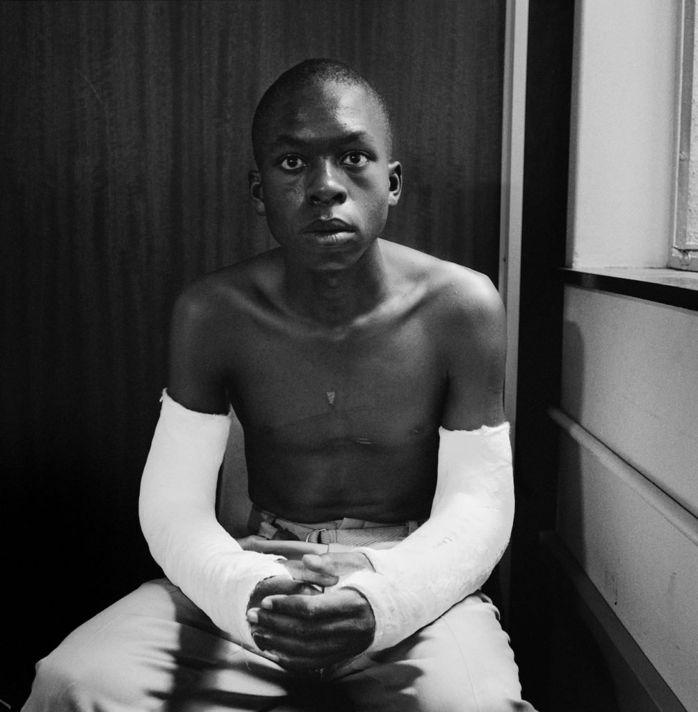 David Goldblatt, 'Lawrence Matjee after assault and detention by the Security Police, 1985. Museum no. E.113-1992, © Victoria and Albert Museum, London