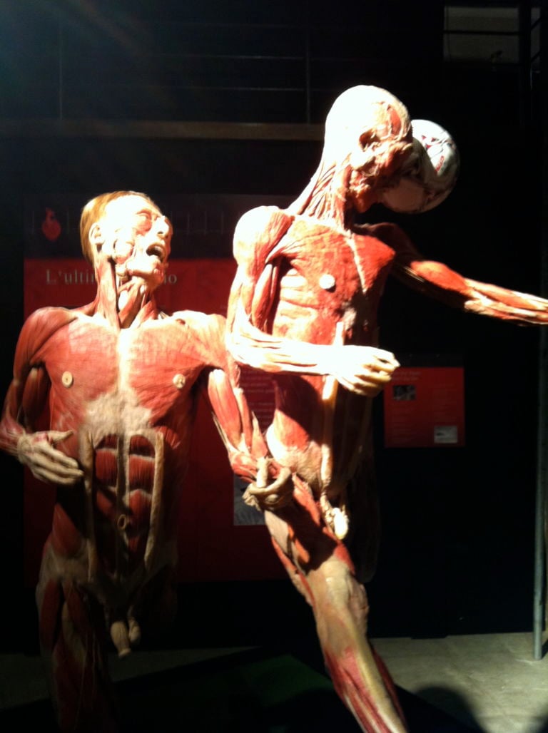 Body Worlds – Il vero mondo del corpo umano 4 Macché Damien Hirst, qui si espongono cadaveri veri. Arriva a Roma Body Worlds, la mostra dei record e delle sicure polemiche. Foto in anteprima solo per stomaci forti