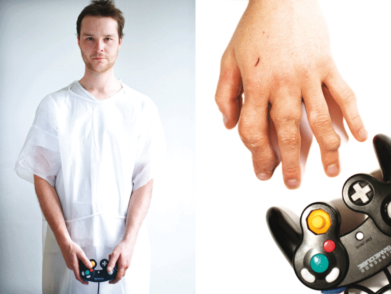 Nintendo Arthritis corrected (Video)giochi proibiti
