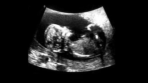 L’ecografia del bebé di Marni Kotak foto Microscope Gallery Art Digest: live birth in galleria a Brooklyn. Twittare ad arte a Berlino. Le Asturie bocciano Niemeyer