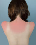 ©Brea Souders Counterforms Sunburn in Naples 2010 StartMilano 2012 - Serata di opening da Nina Due e Camera16