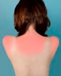 Brea Souders Counterforms Sunburn in Naples 2010 Fashion victim da galleria o artisti da passerella?