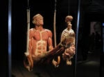 IMG 4358 Body Worlds. A mente aperta, a corpo libero