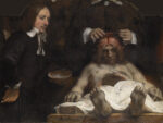 Rembrandt van Rijn, La lezione di anatomia del Dr Joan Deyman, 1656 - Amsterdam Museum