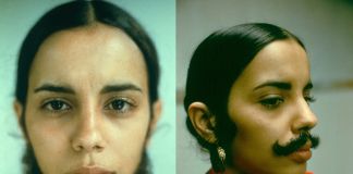 Ana Mendieta, Facial Hair Transplant, 1972