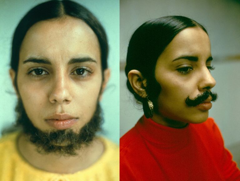 Ana Mendieta, Facial Hair Transplant, 1972