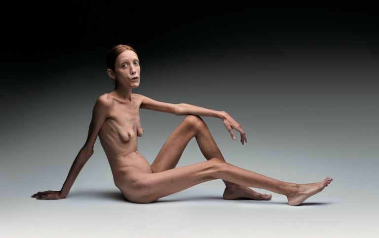 Anoressia 2006 ©olivierotoscani