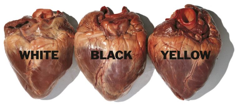 ©olivierotoscani