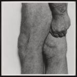 John Coplans, Knees with Fist, Side View, 1984 © The John Coplans Trust. Courtesy The John Coplans Trust, Galerie Nordenhake Berlin Stockholm, P420, Bologna