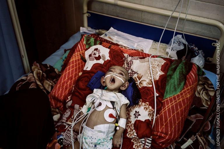 Yemen Crisis © Lorenzo Tugnoli, Contrasto, for The Washington Post