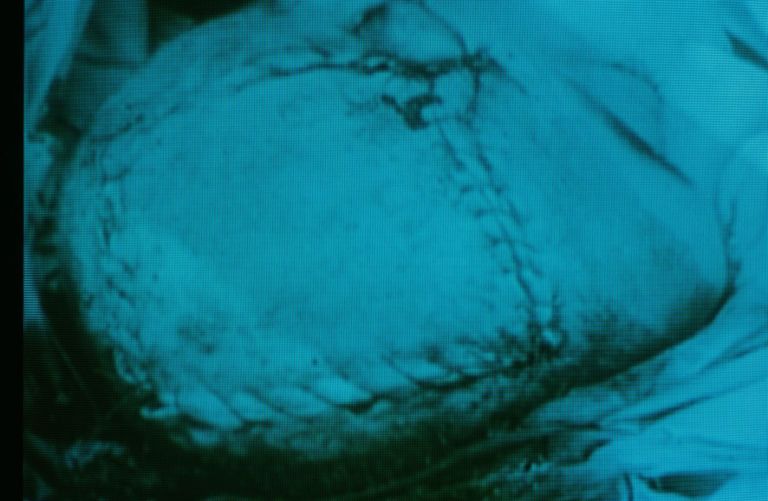 Yervant Gianikian Angela Ricci Lucchi Trittico del XX secolo. Il corpo ferito 2002. Frame da video MART Rovereto Gianikian/Ricci Lucchi e Italo Zannier: riflessioni sull'immagine a Rovereto