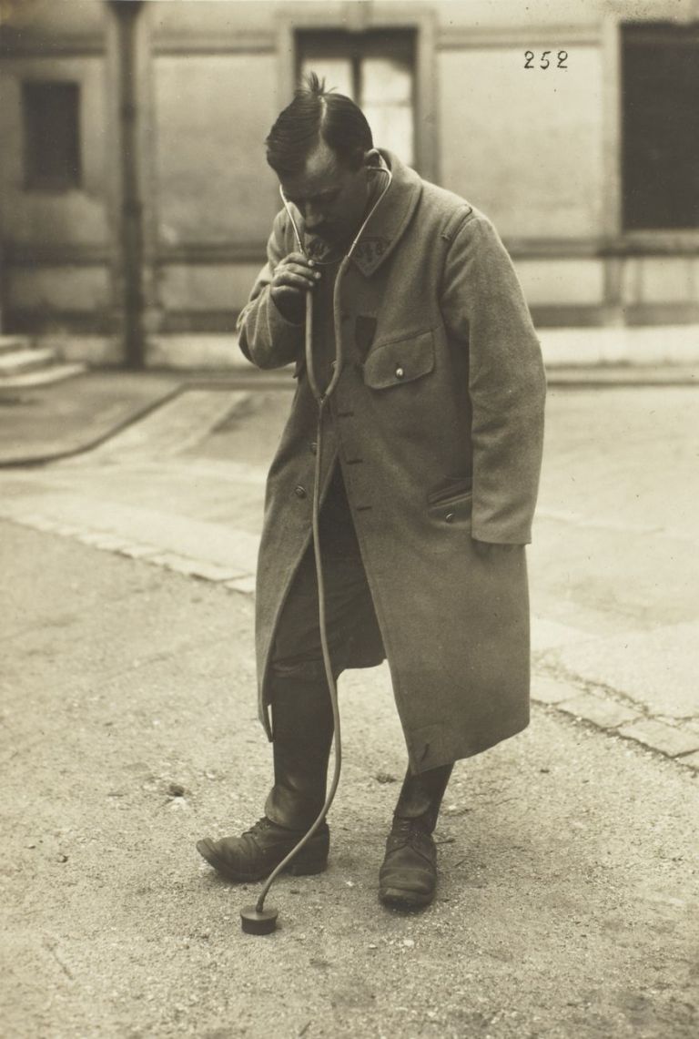 Dispositivo di ascolto per la sorveglianza a terra, 1917 18, stampa ai sali d’argento. Archives Nationales, Francia