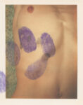 Ulay, Retouching Bruises. Courtesy ULAY Foundation