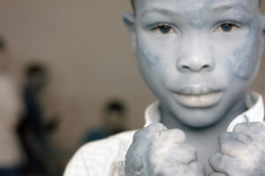 Fotografare le cicatrici all’infrarosso. Monica Carocci in Africa per CUTE Project