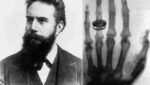 Wilhelm Röntgen e la mano sinistra di Anna Bertha Ludwig nella prima radiografia della storia