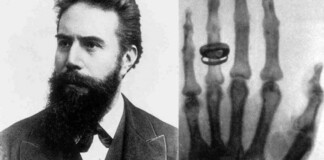 Wilhelm Röntgen e la mano sinistra di Anna Bertha Ludwig nella prima radiografia della storia