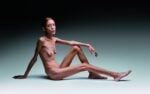 Oliviero Toscani, No Anorexia, 2007 © Oliviero Toscani