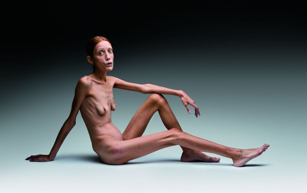 Oliviero Toscani, No Anorexia, 2007 © Oliviero Toscani