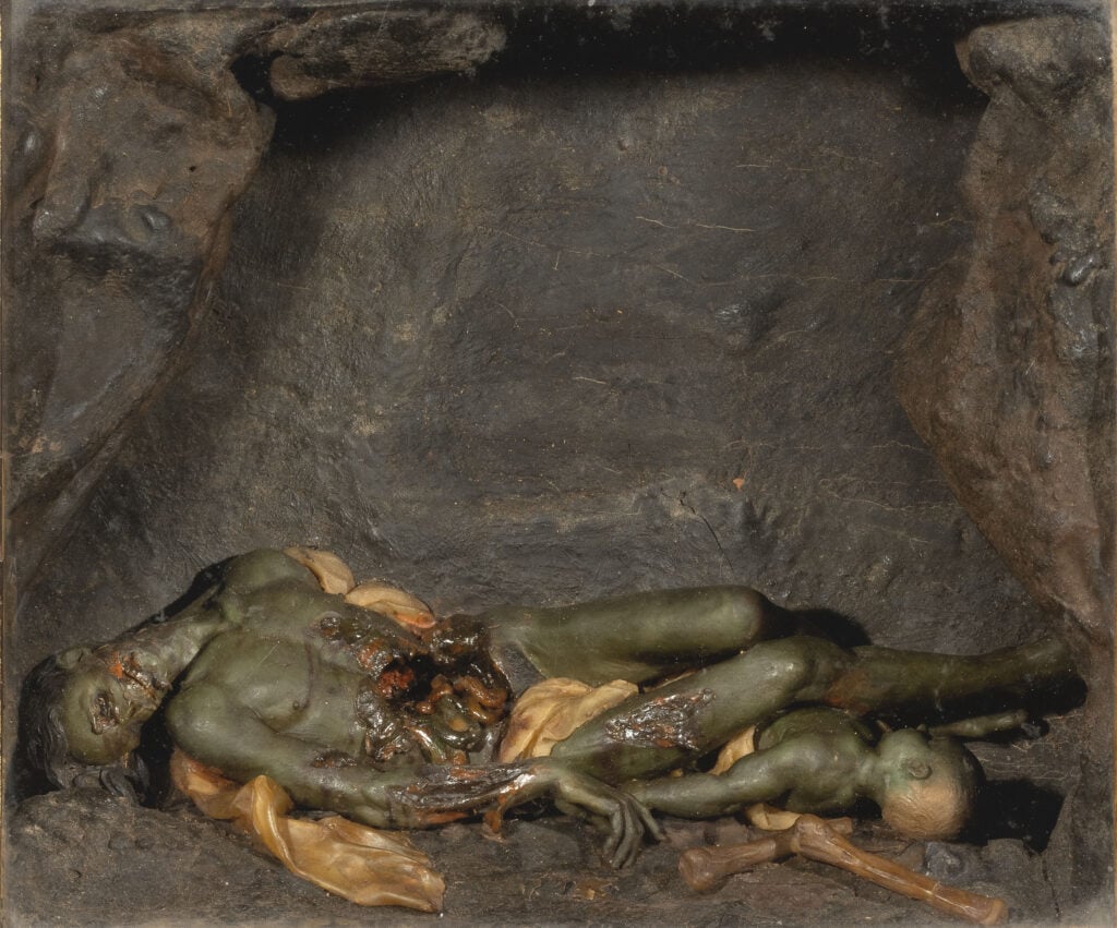 Gaetano Giulio Zumbo, Corruzione dei Corpi