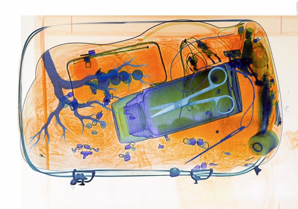 Fariba Ferdosi – X-Ray-Me