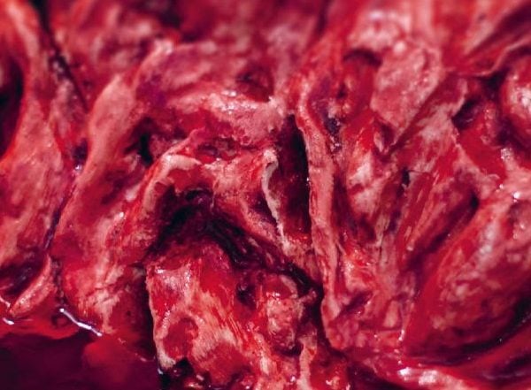 Lucia Tkáčová – Pain Chain