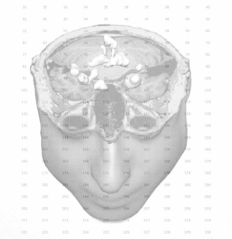 Itamar Gilboa – World of Plenty