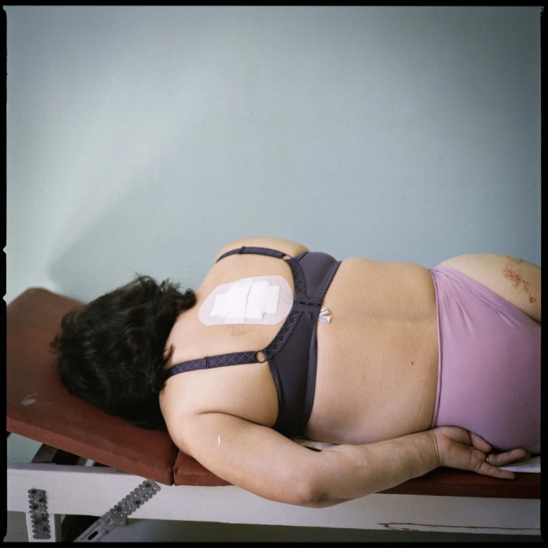 Anastasia Taylor-Lind, Woman with Surgical Dressing, 5K from the Frontline, 2014, Sloviansk, Ucraina