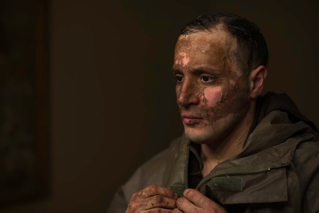 Oscar Giaconia, Hoysteria