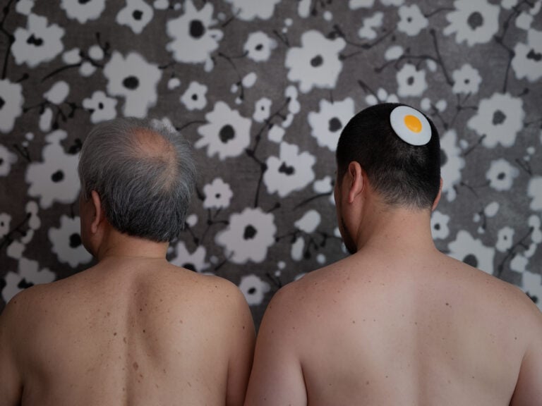 Hyunmin Ryu, Genetic anxiety, Ryu Sang-Lag